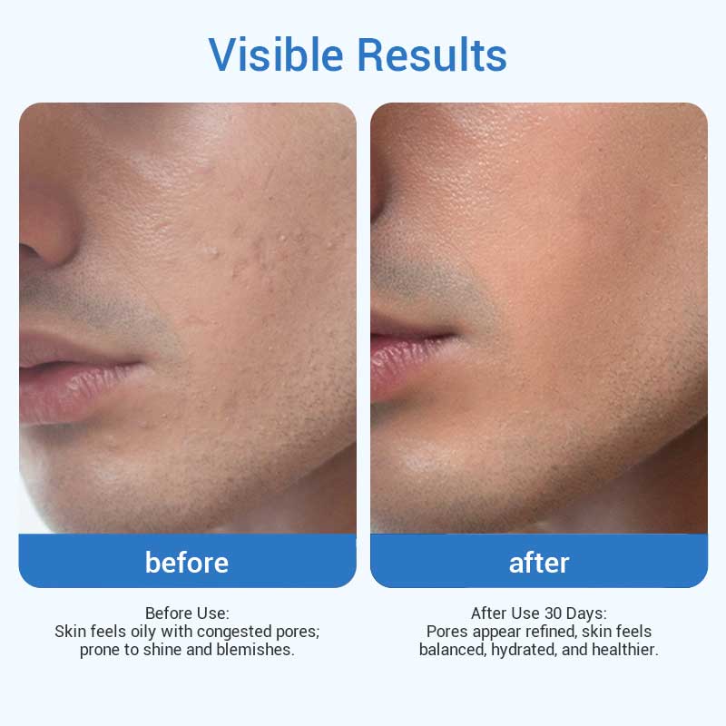 private label men oil control cleanser